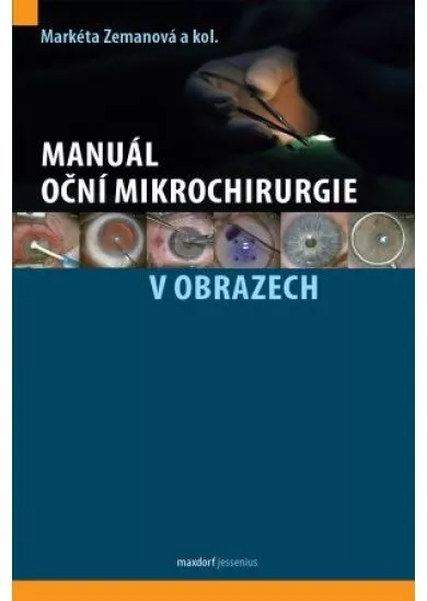 Manuál oční mikrochirurgie v obrazech