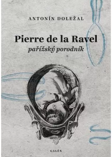 Pierre de la Ravel, pařížský porodník