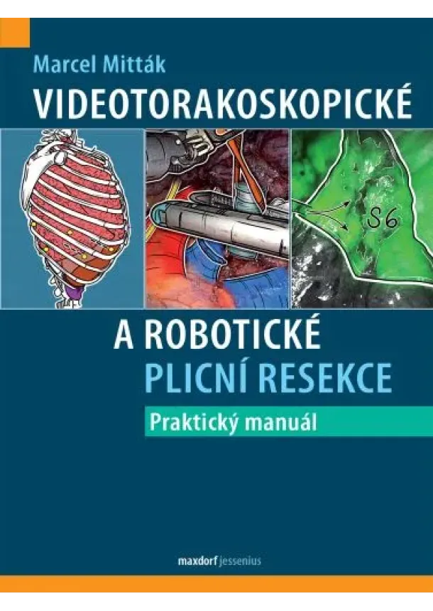 Marcel Mitták - Videotorakoskopické a robotické plicní resekce - Praktický manuál