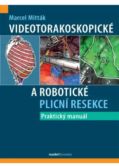 Videotorakoskopické a robotické plicní resekce - Praktický manuál