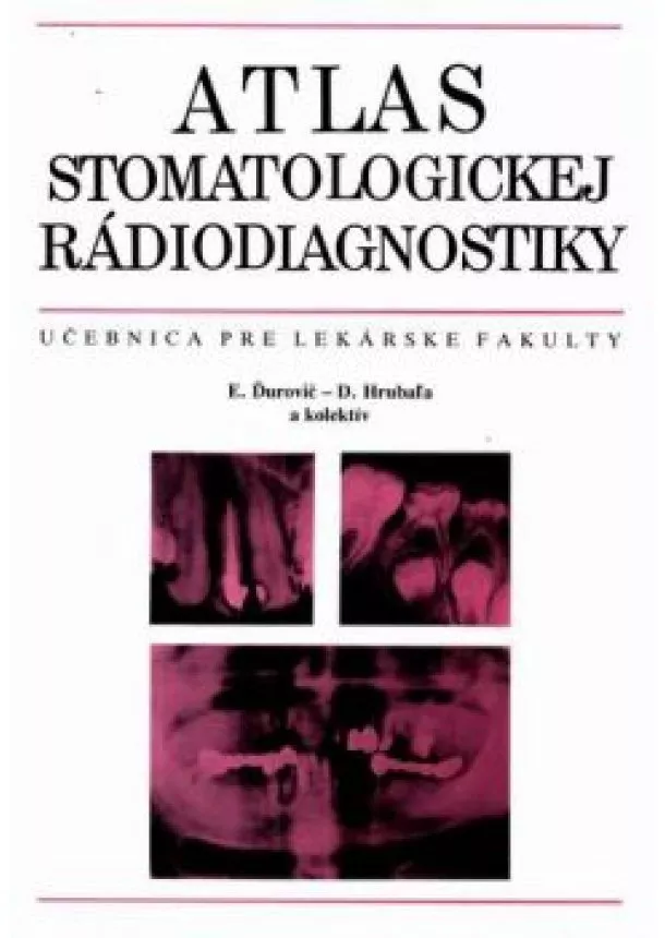 E. Ďurovič, D. Hrubal'a a kolektív autorov - Atlas stomatologickej rádiodiagnostiky - Učebnica pre lekárske fakulty