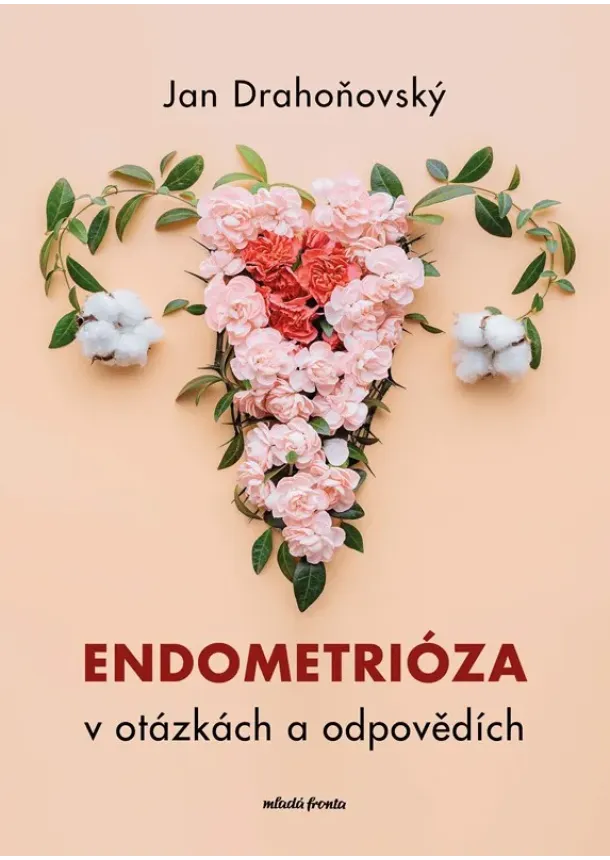 Jan Drahoňovský - Endometrióza v otázkách a odpovědích