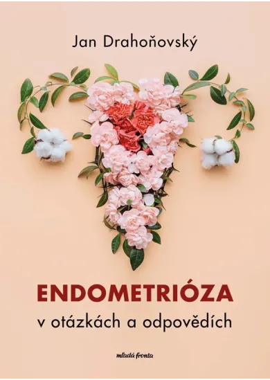 Endometrióza v otázkách a odpovědích