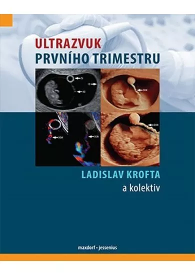 Ultrazvuk prvního trimestru