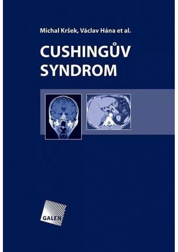 Michal Kršek, Václav Hána et al. - Cushingův syndrom