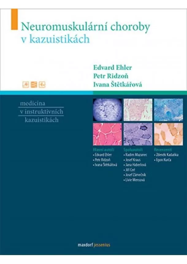 Edvard Ehler, Petr Ridzoň, Ivana Štětkářová - Neuromuskulární choroby v kazuistikách