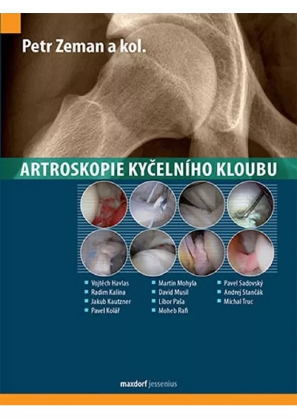 Petr Zeman - Artroskopie kyčelního kloubu