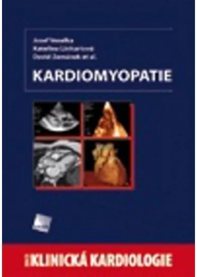 Kardiomyopatie