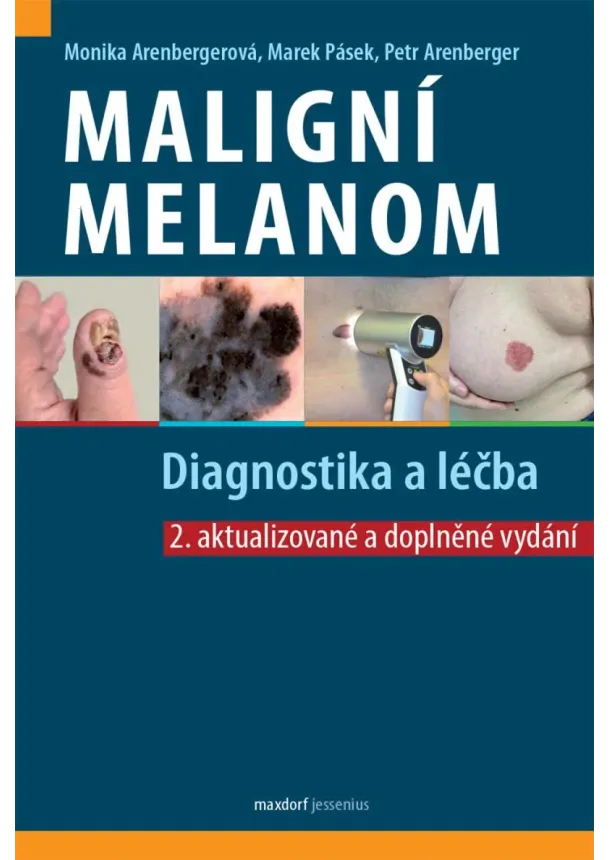 Monika Arenbergerová, Marek Pásek, Petr Arenberger - Maligní melanom (2.aktualizované a doplněné vydání) - Diagnostika a léčba