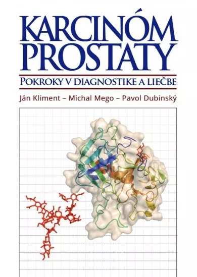 Karcinóm prostaty - Pokroky v diagnostike a liečbe