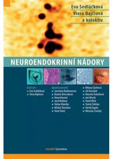 Neuroendokrinní nádory