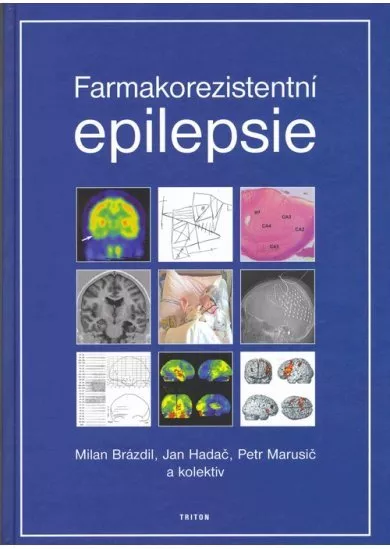 Farmakorezistentní epilepsie
